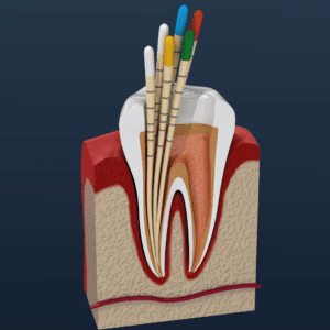 endodontie oradea