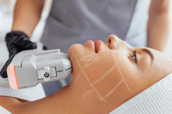 hifu hifu facial hifu oradea