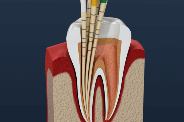 endodontie oradea