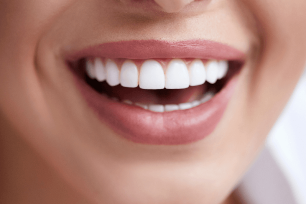 estetica dentara oradea